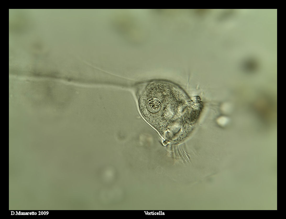 Vorticella...